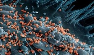 Lassa Fever Death Rate Rises In Nigeria Despite Drop In New Cases – NCDC