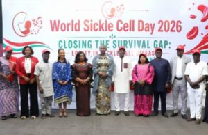 Nigeria Moves to Close Sickle Cell Survival Gap with Expanded Screening, Treatment Access
